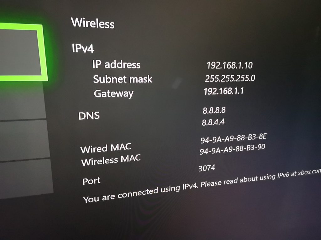 how to set static ip xbox one