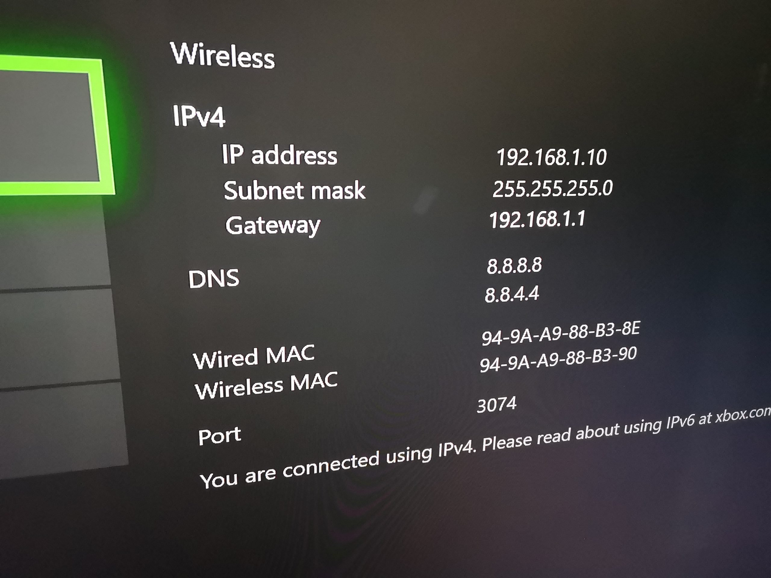 pump chain Frank How To Set Static IP On Xbox One - Xbox One